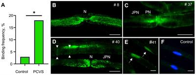 High serum prevalence of autoreactive IgG antibodies against peripheral nerve structures in patients with neurological post-COVID-19 vaccination syndrome